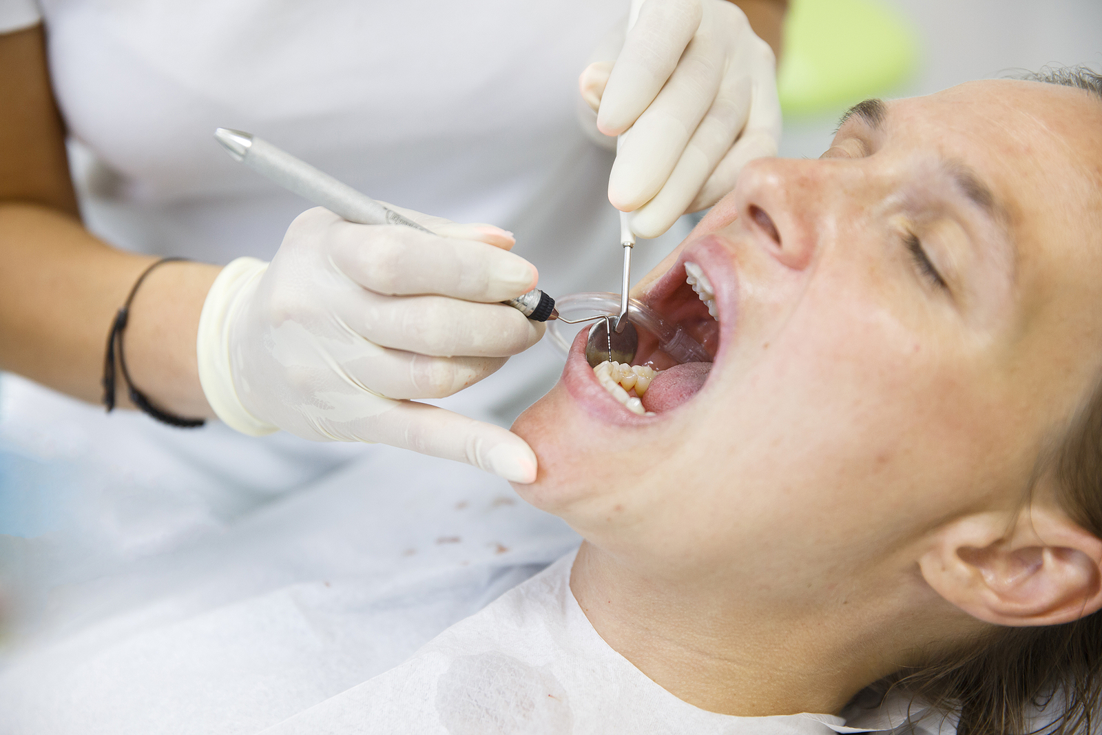 The Importance Of General Dentistry: How Regular Checkups And Cleanings Can Keep Your Smile Healthy